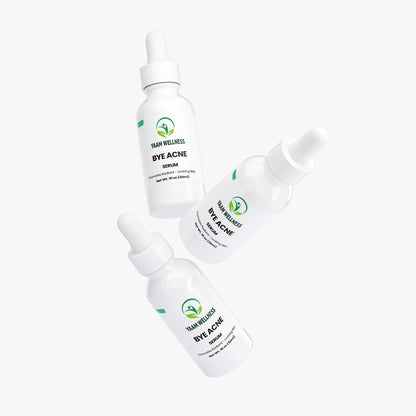 Bye Acne Serum YAAM Wellness